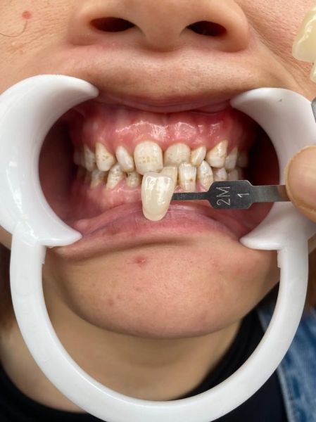 牙不好影响财运吗_牙齿风水与财富关系