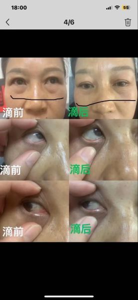 眼睛长财运好吗_面相学可信吗