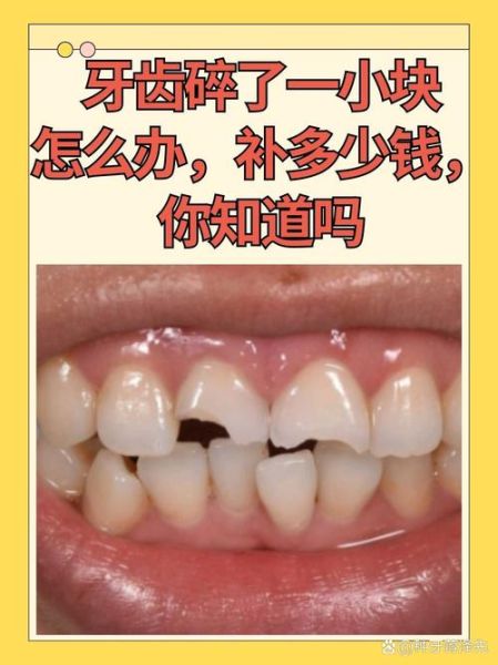 牙齿形状与财运_牙齿形状真的影响财富吗