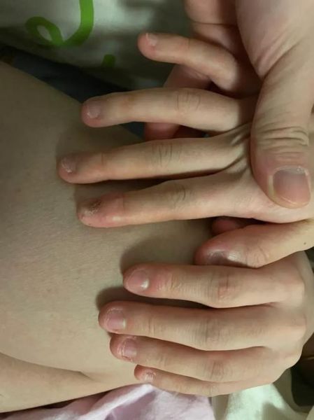 梦到咬指甲_梦见咬指甲意味着什么