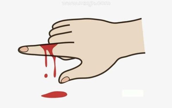 梦到受伤流血是什么意思_梦到受伤流血怎么办