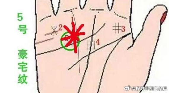 掌心财运线怎么看_财运线断了怎么办