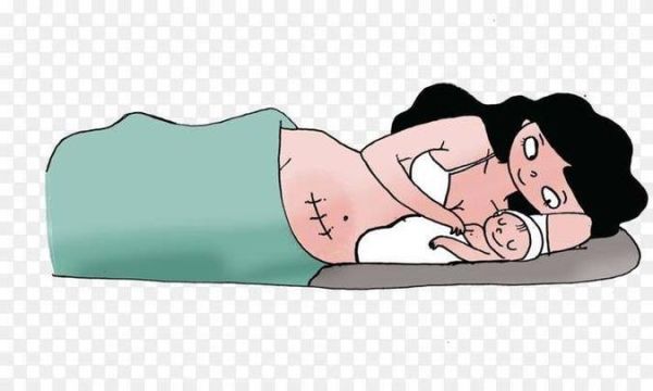 梦见自己剖腹产_意味着什么