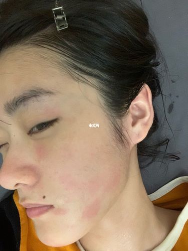 梦到脸很脏是什么意思_梦到脸很脏怎么破解