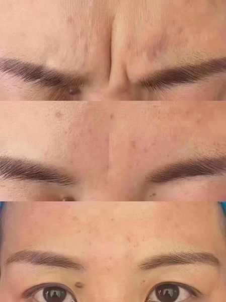 额头有川字纹财运好吗_额头纹路看财富运势