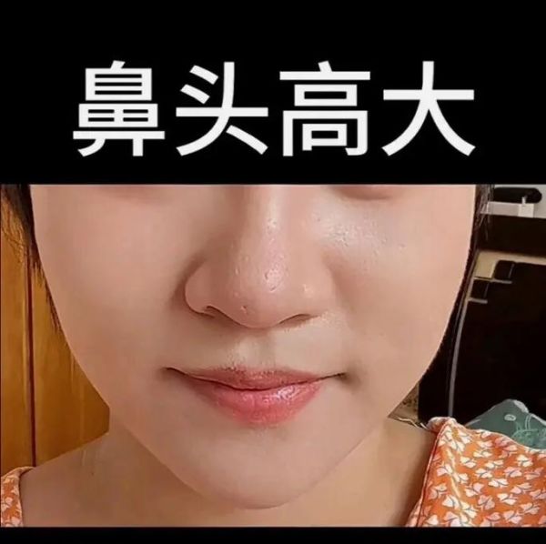 鼻子疼财运_鼻子疼预示什么财运