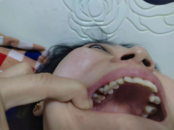 牙齿掉了财运不佳_民间说法可信吗