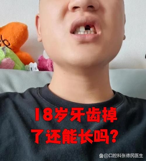 牙齿掉了会影响财运吗_民间说法科学吗