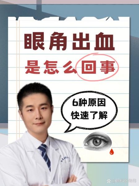 梦到别人眼睛流血是什么意思_梦见别人眼睛流血预示什么