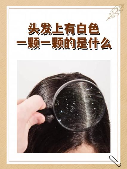 梦到生发是什么意思_梦到头发长出来预示着什么