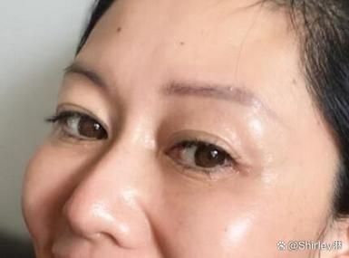 梦到做双眼皮是什么意思_做双眼皮前最担心什么