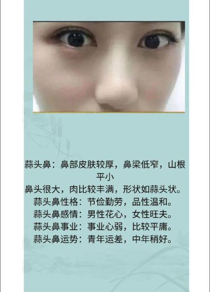蒜头鼻的男人财运好吗_蒜头鼻男人怎么提升财运