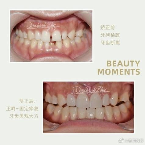 牙齿看财运_牙齿与财富的关系