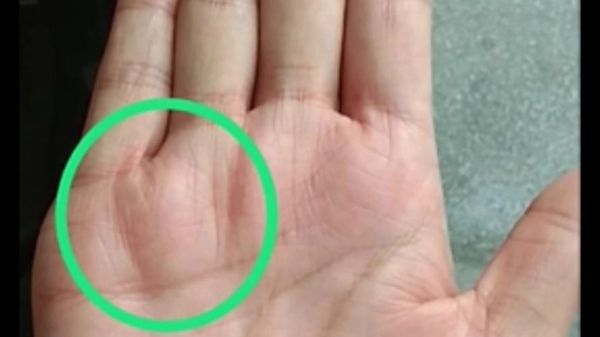 太阳丘在哪_太阳丘饱满就一定有钱吗